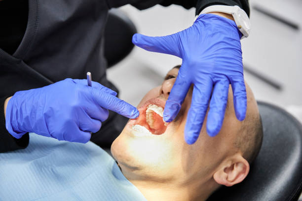 Best Emergency Wisdom Teeth Removal in Barbourmeade, KY